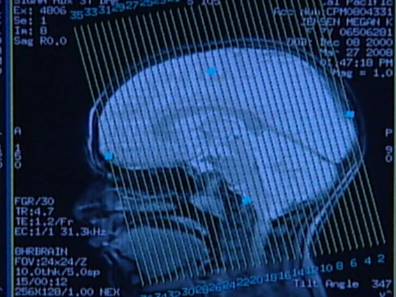 brain scan image